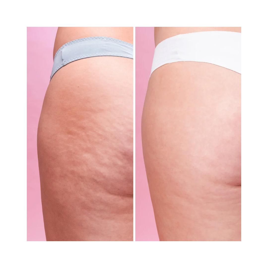 Scrub Corpo Anticellulite