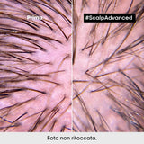 SERIE EXPERT New Scalp Advanced Shampoo Anti-Discomfort