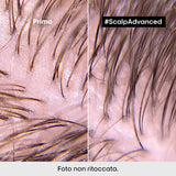 SERIE EXPERT New Scalp Advanced Shampoo Anti-Oiliness