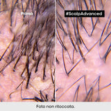 SERIE EXPERT New Scalp Advanced Shampoo Anti-Dandruff