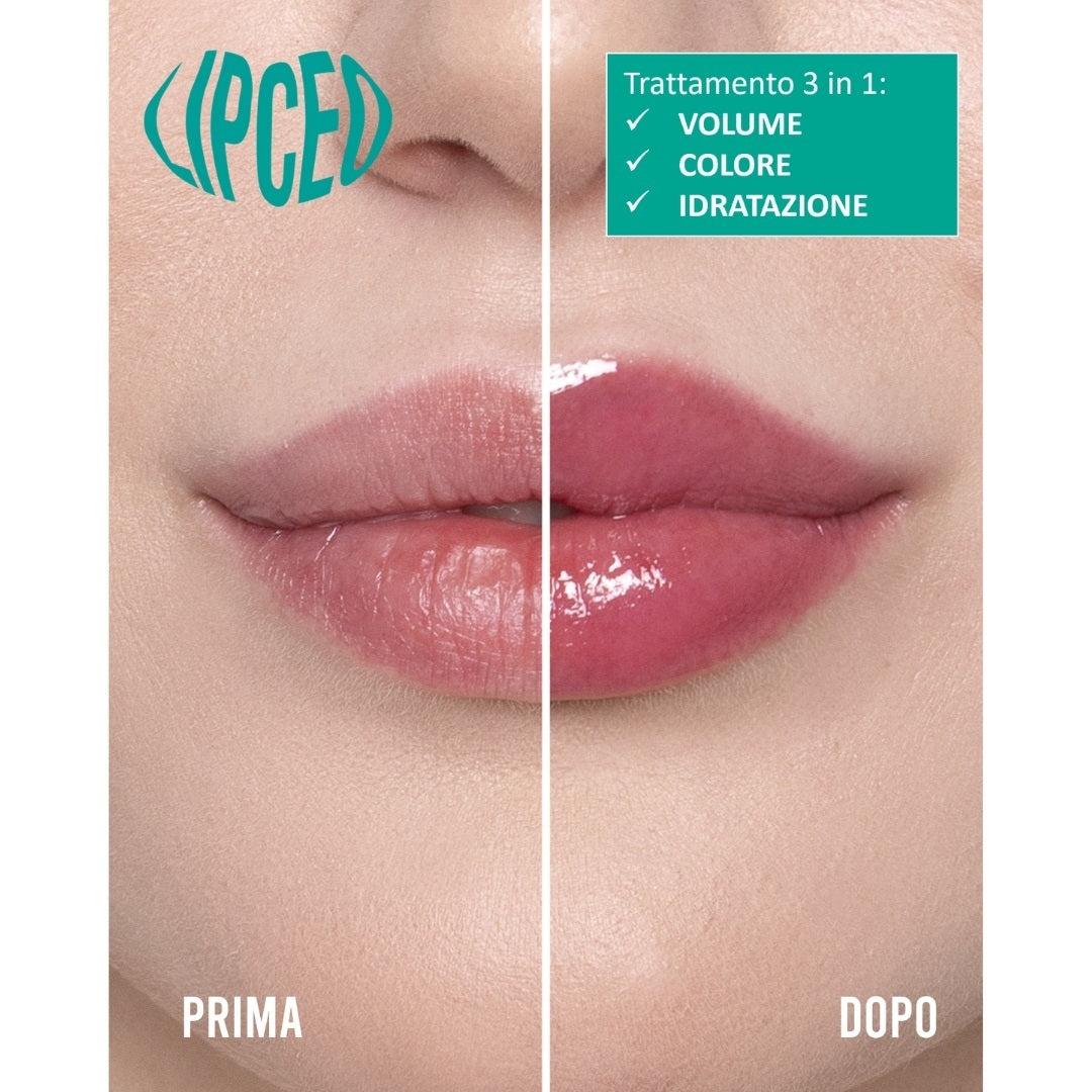 Lip Ceo