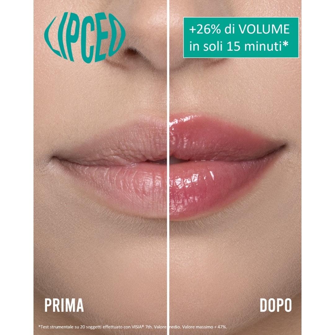 Lip Ceo