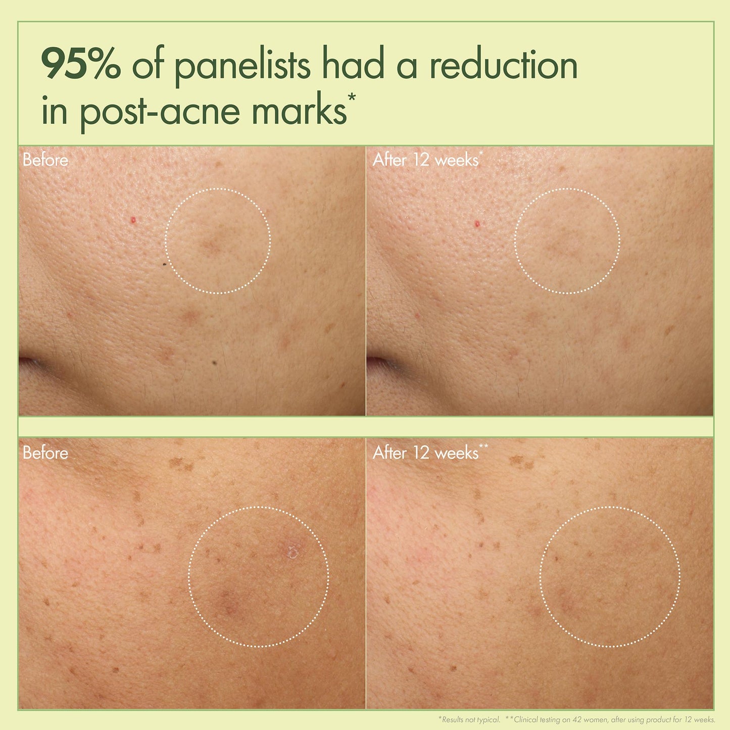 Dr Weil Mega-Mushroom Dark Spot Corrector Moisturizer