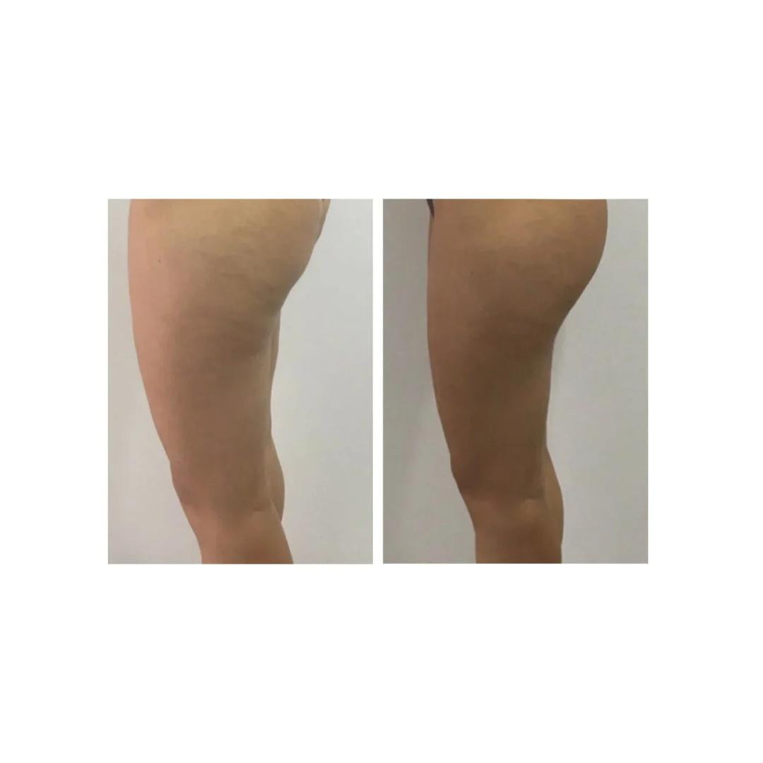 Crema Corpo Rassodante