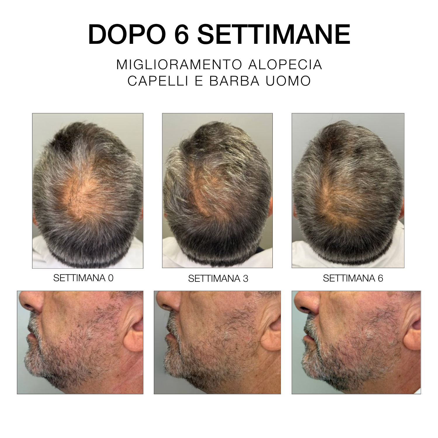 Estremirimedi - Siero 6 - Trattamento Fortificante Scalpo & Capelli