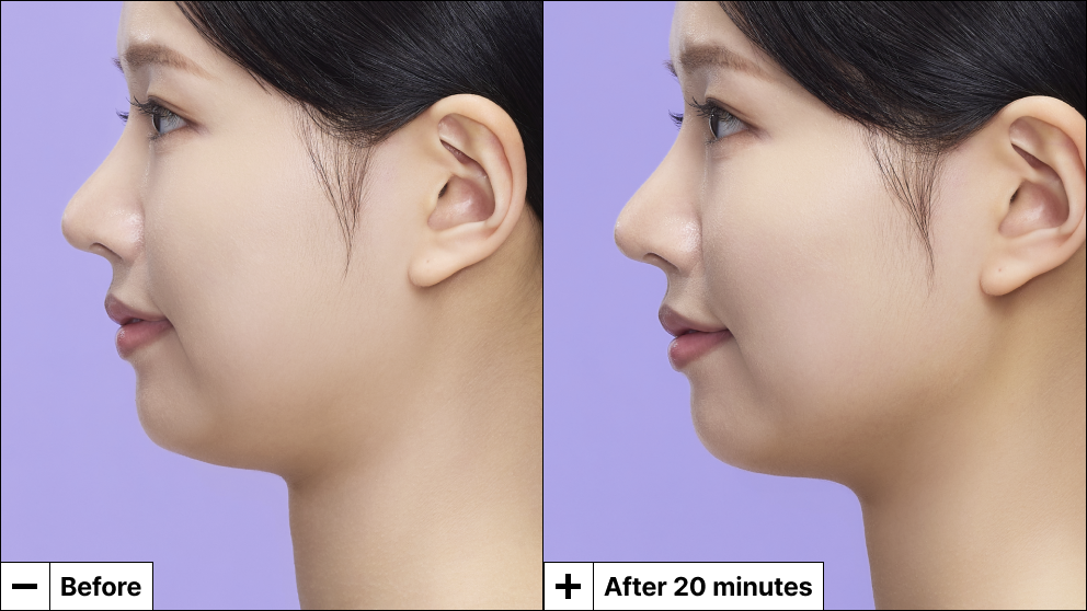 Cryo Jawline Lifting Mask