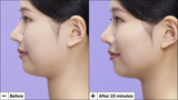 Cryo Jawline Lifting Mask