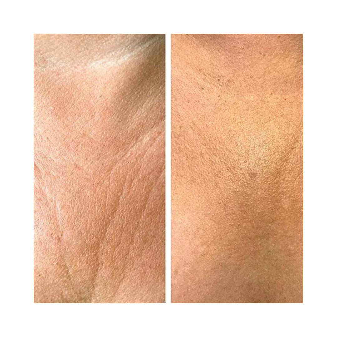 Crema Anti Rughe Décolleté