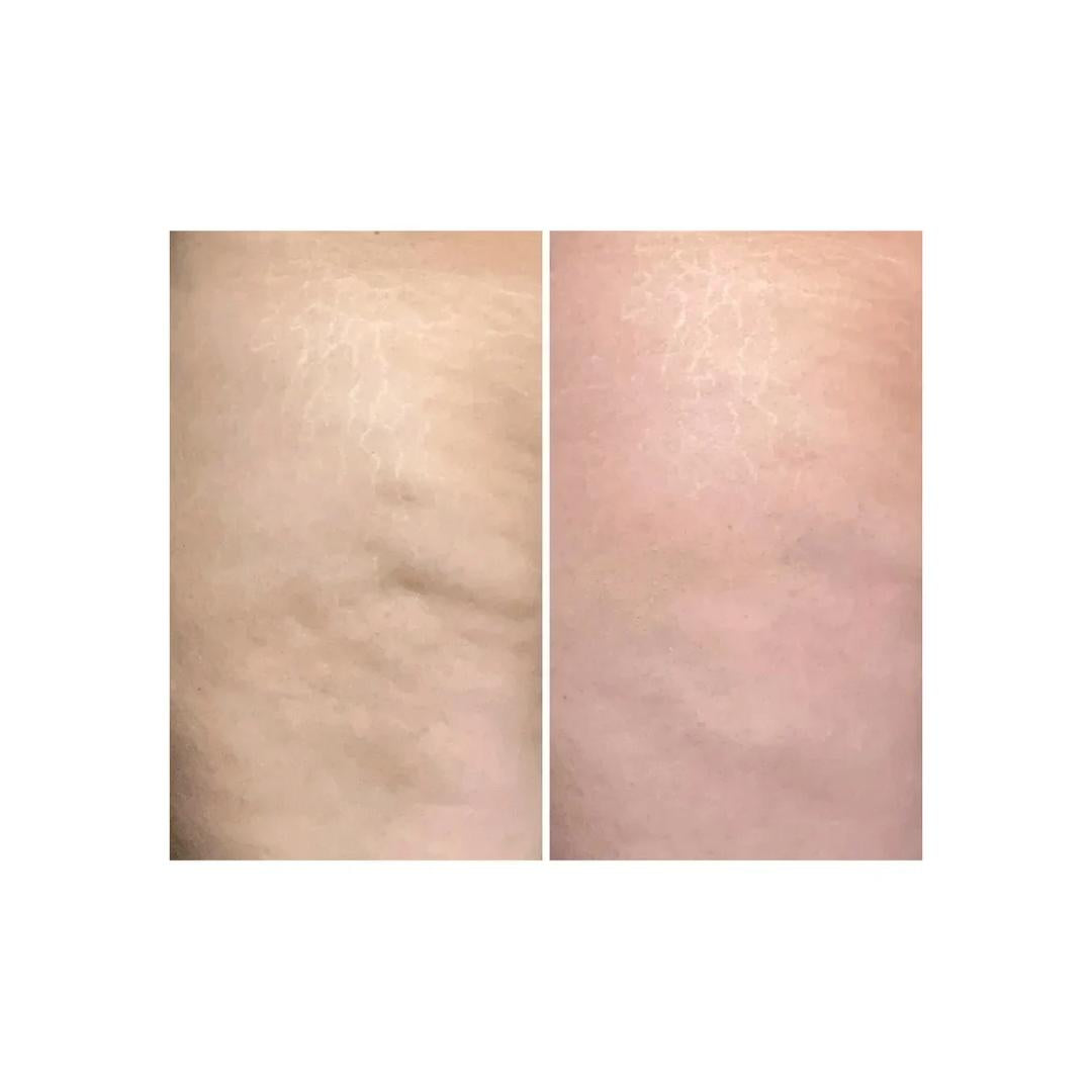 Crema Corpo Anticellulite