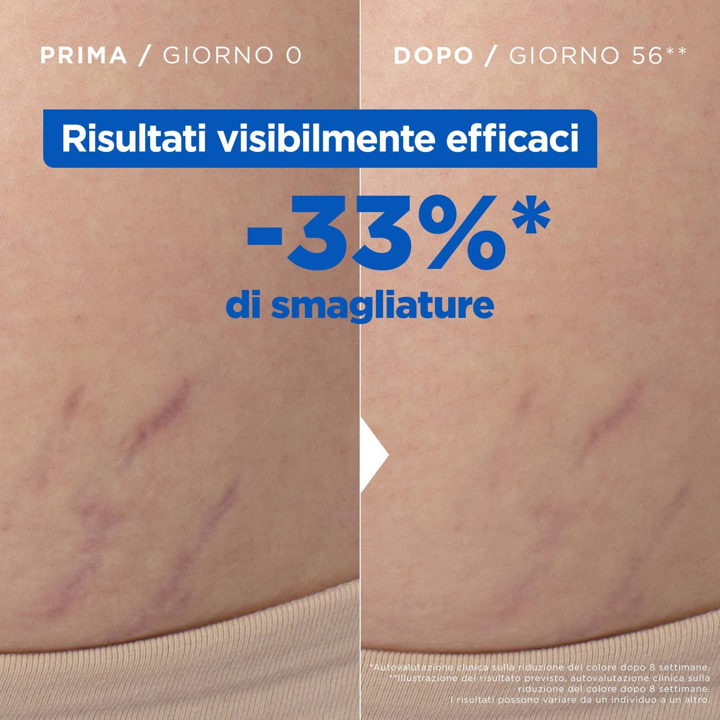Niacinamide Bright Olio Smagliature