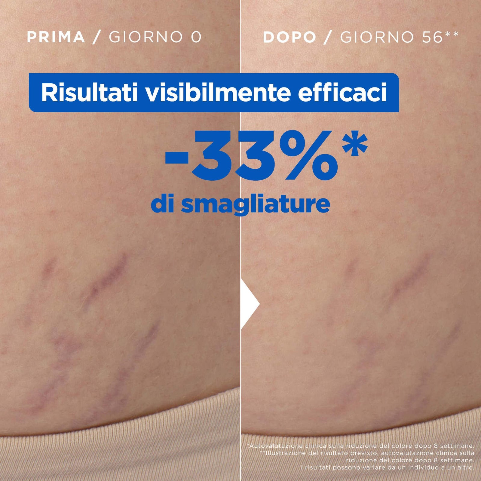 Niacinamide Bright Olio Smagliature