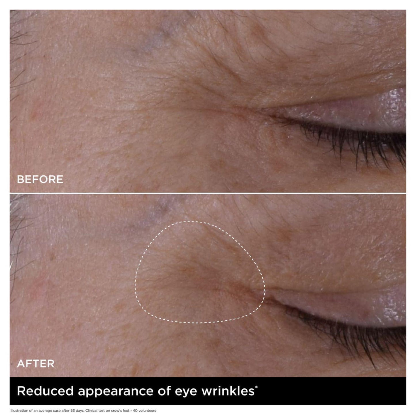 Double Serum Eye