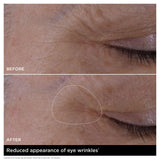 Double Serum Eye