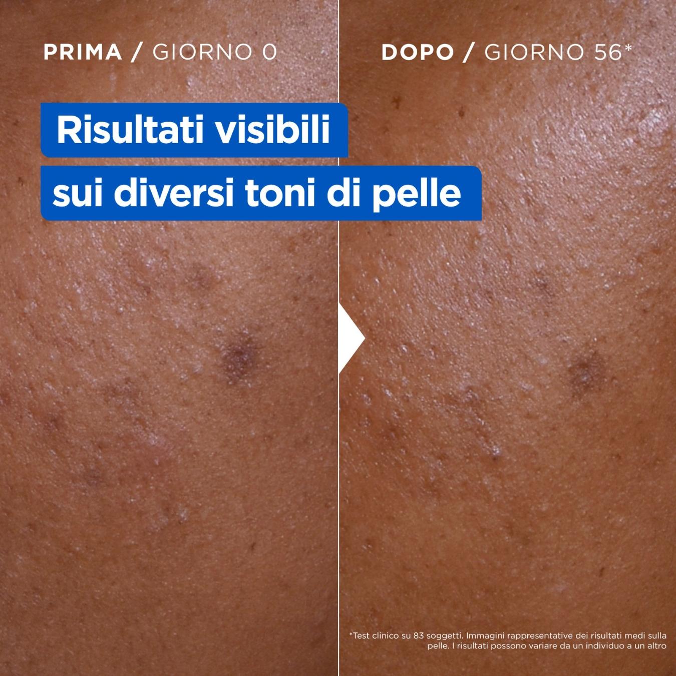 Niacinamide Bright Latte Corpo Illuminante e Idratante