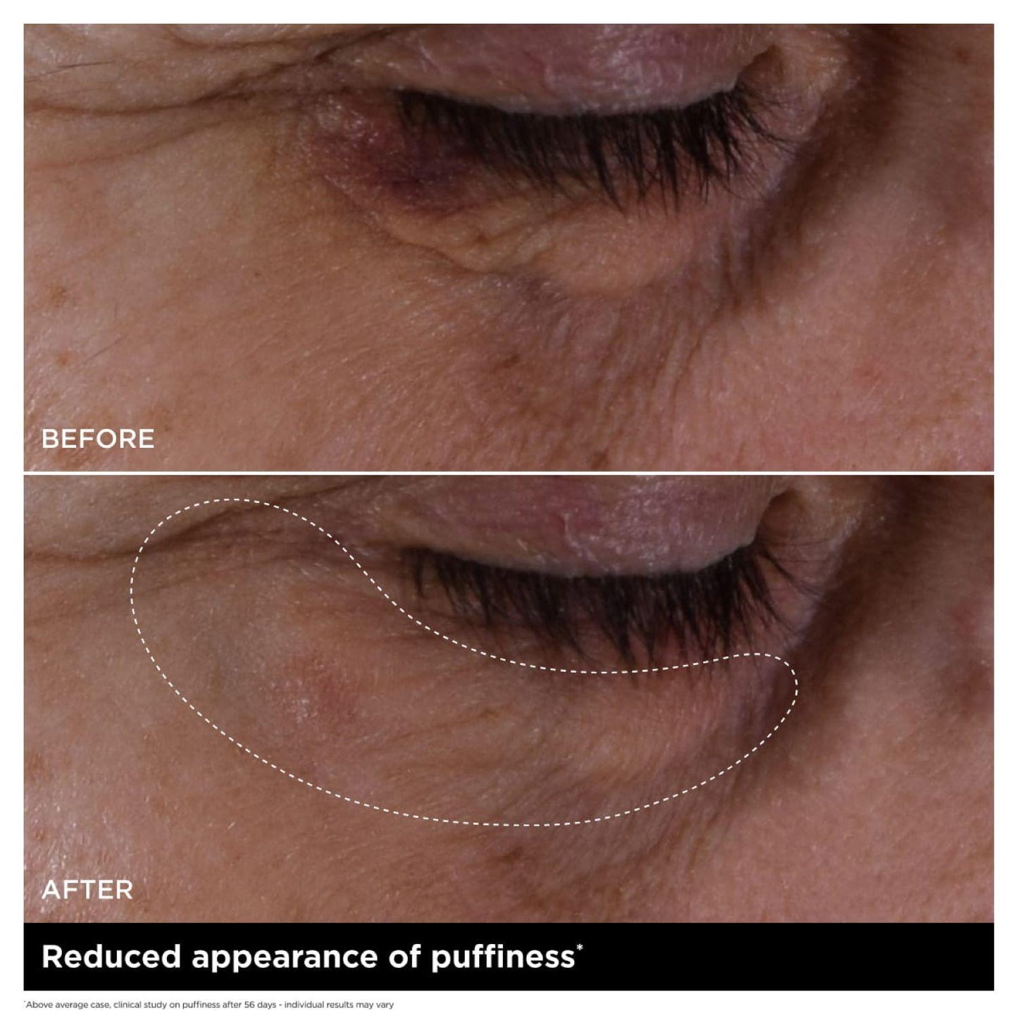 Double Serum Eye