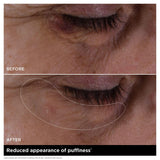 Double Serum Eye