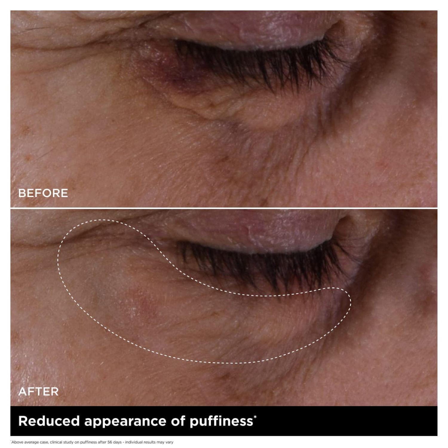 Double Serum Eye